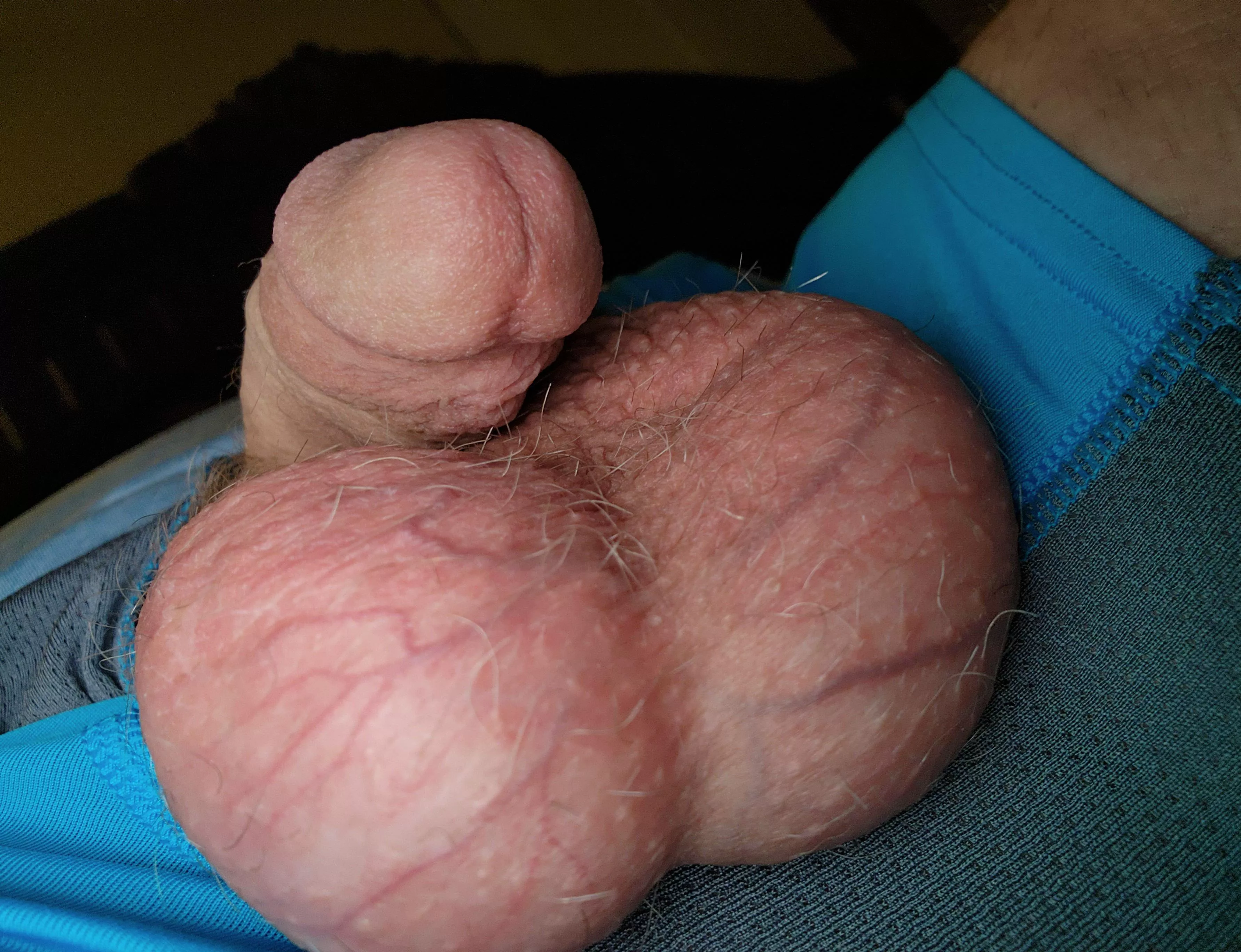 That blood supply! posted by AmandumVitam