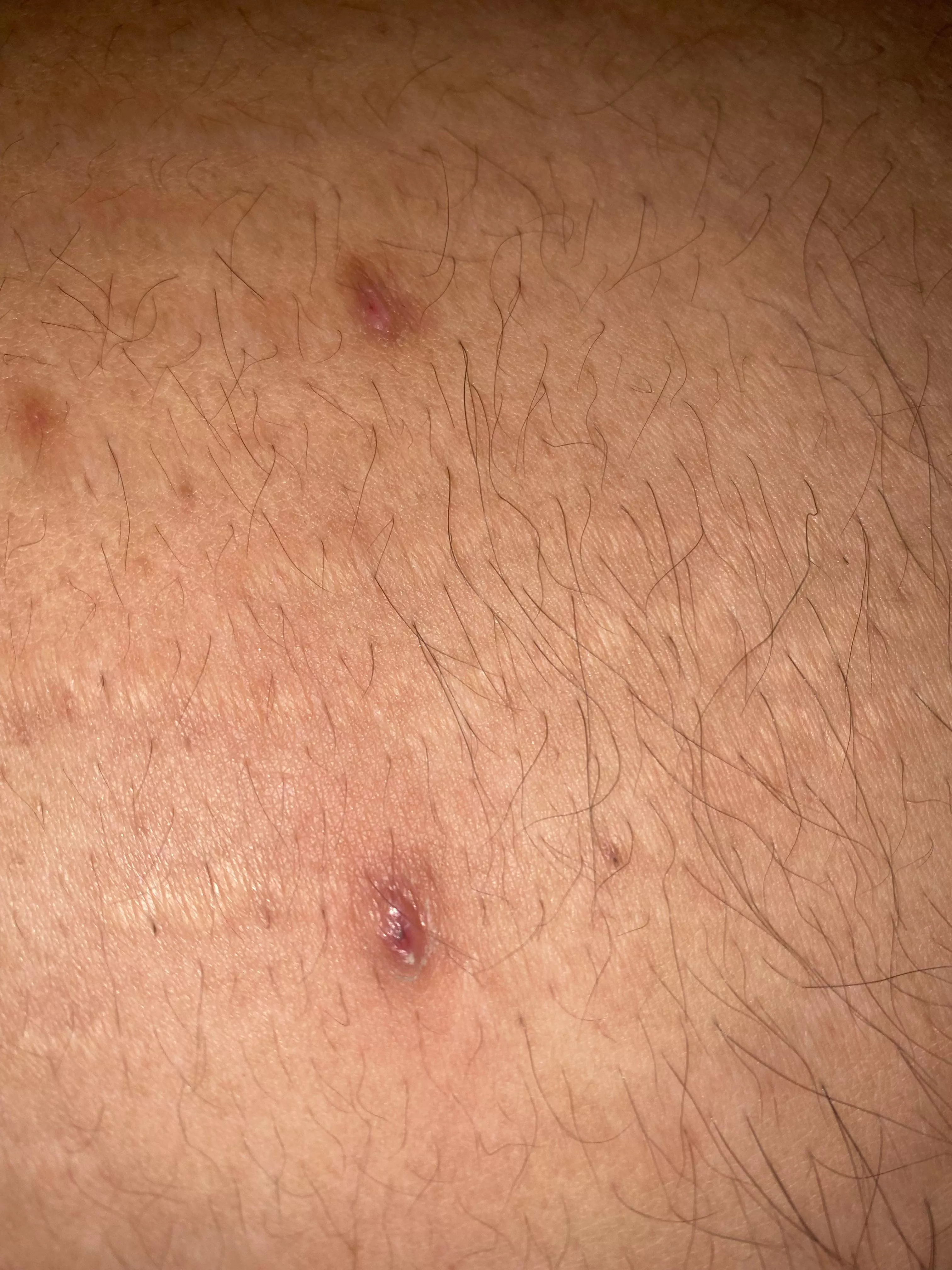 What do these look like to u posted by RyMvrtin