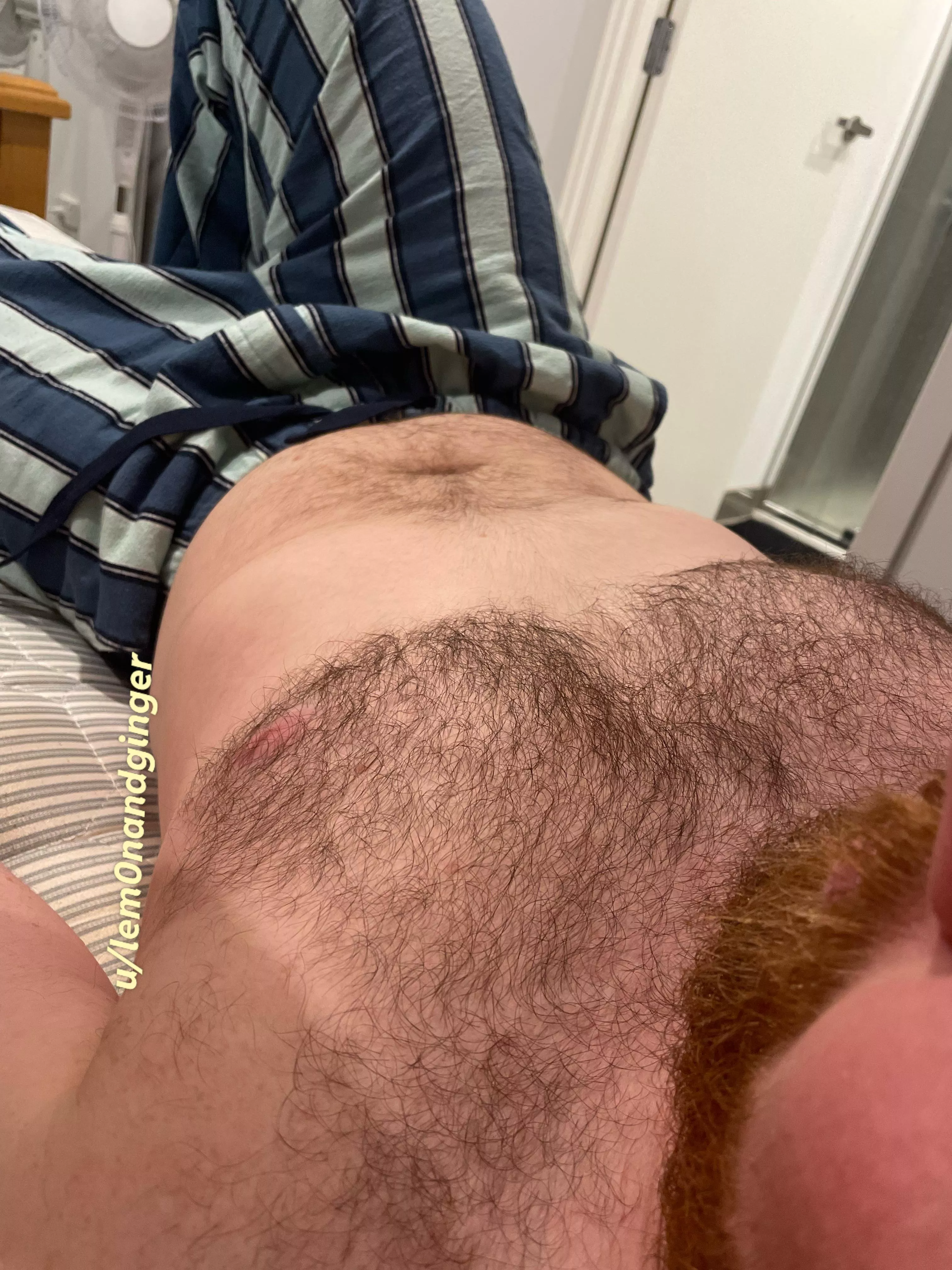 Cheat hair and PJ pants posted by Lem0nandGinger