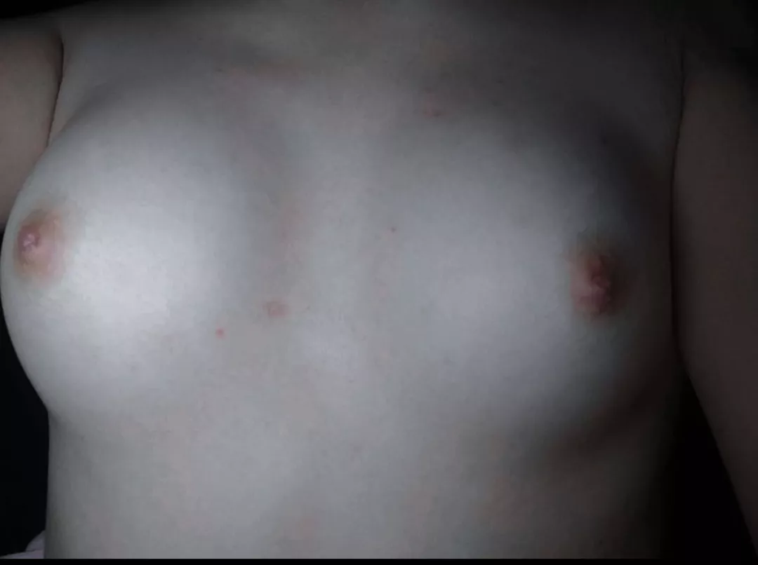 Oooppss.. posted by One_Caramel7482