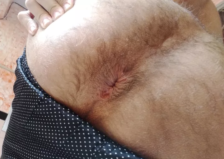 Outside soft asshole posted by JukolJiko