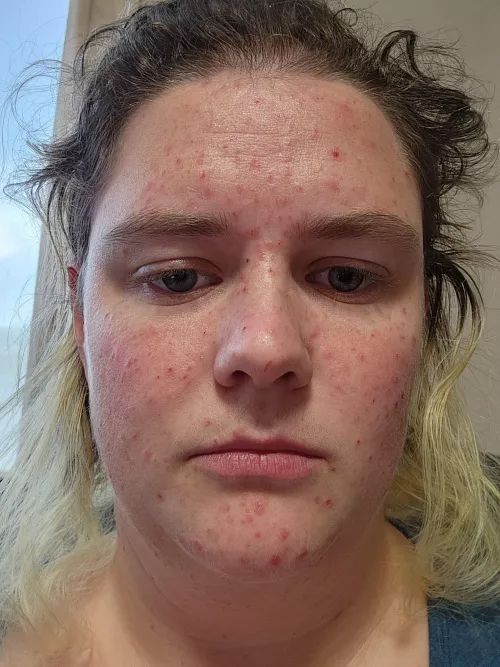 Terrified of posting this but I believe awareness is the key to support and change. by littlepurplecarrot