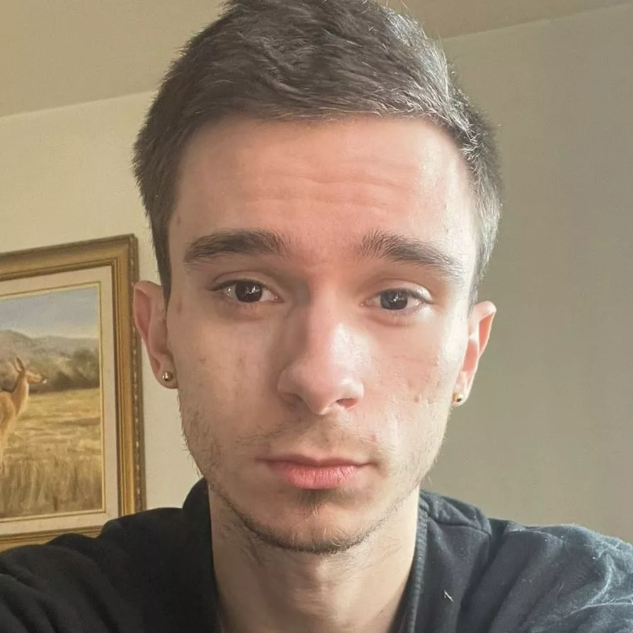 An face selfie:) hi posted by Acrobatic-Bake2084