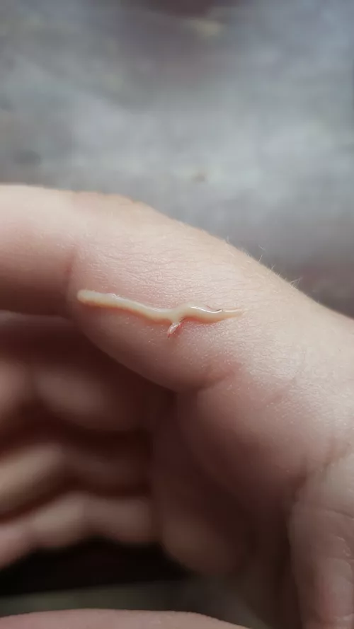 Aftermath of an ingrown hair boil by MirtaGev