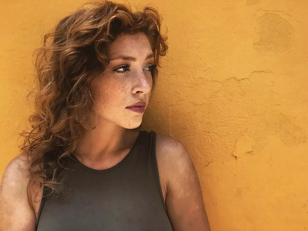 Freckled and fabulous posted by upstairsidolize62