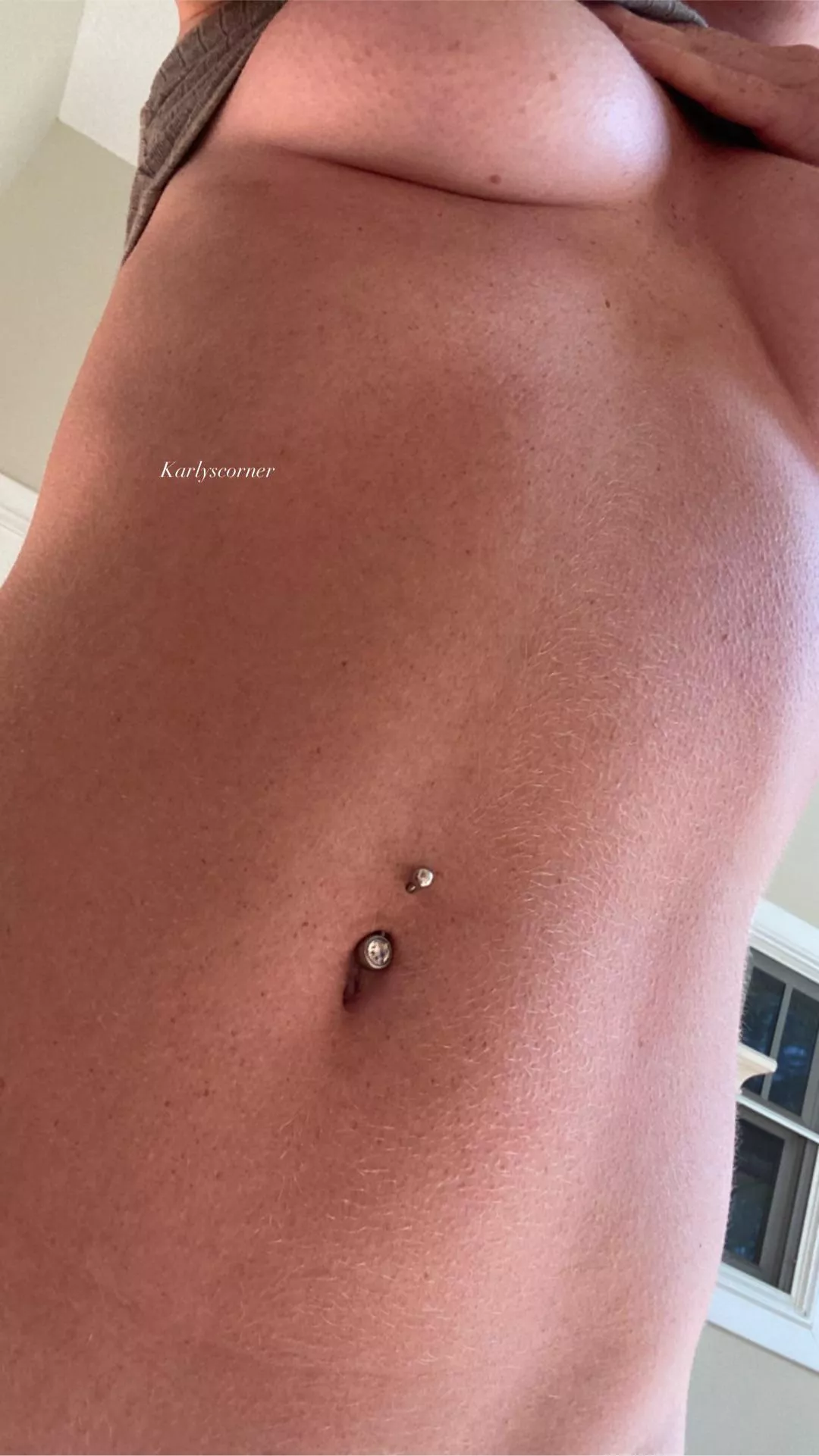 Do men still like freckles posted by Nervous_Wrongdoer_82