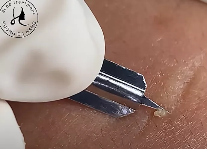 Does anyone know the name of this tool? by frogmicky