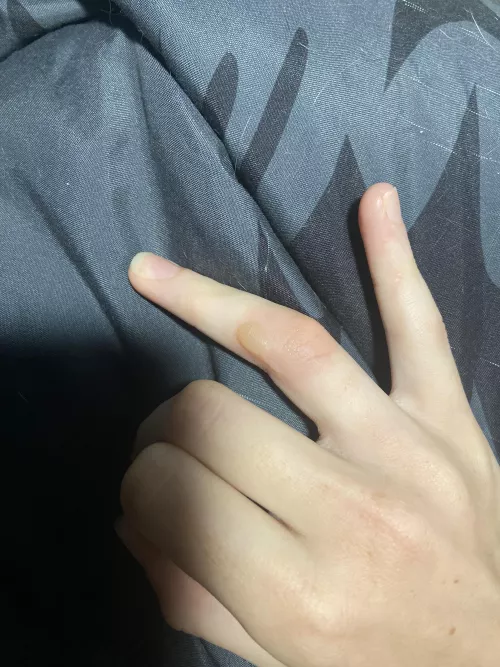 Forbidden pop on finger by pr1ncea1exander