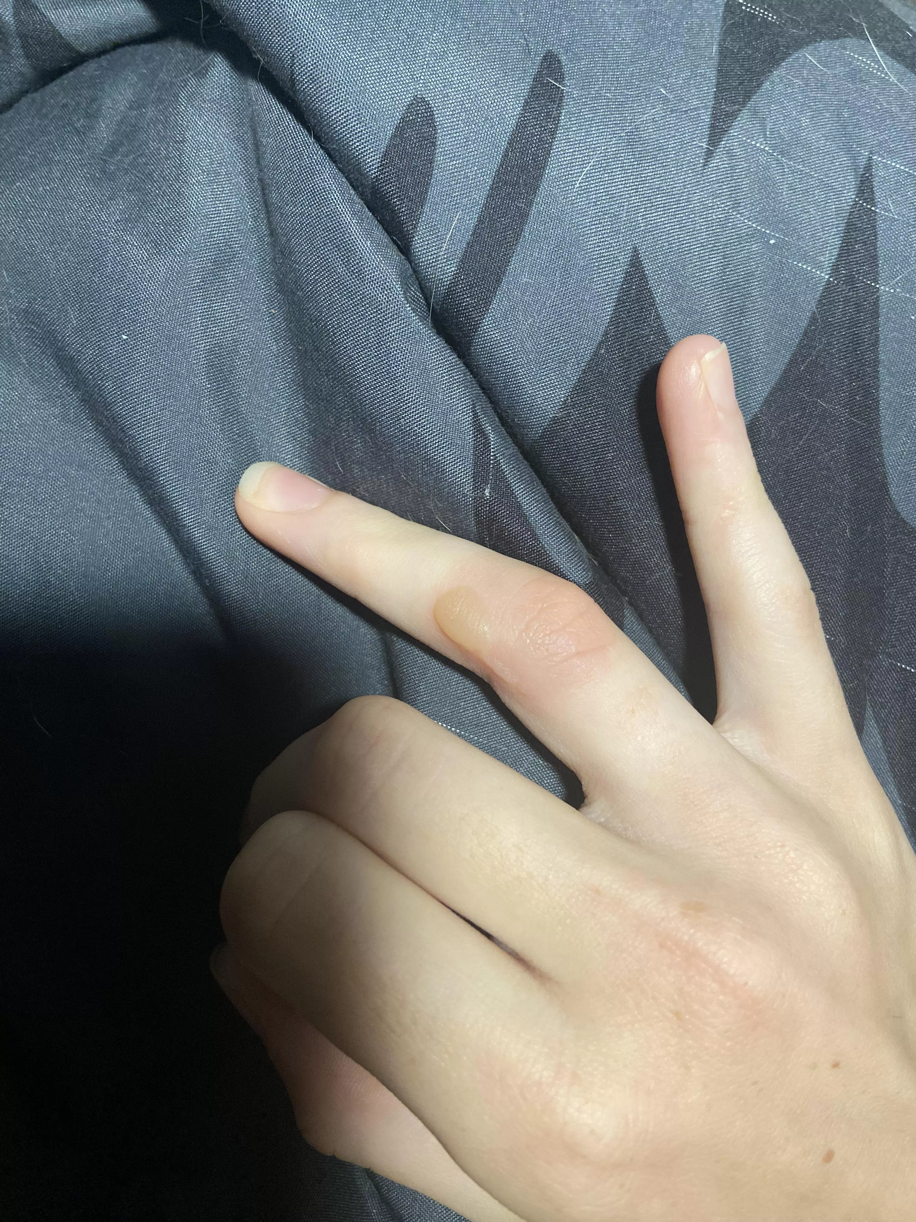 Forbidden pop on finger posted by pr1ncea1exander