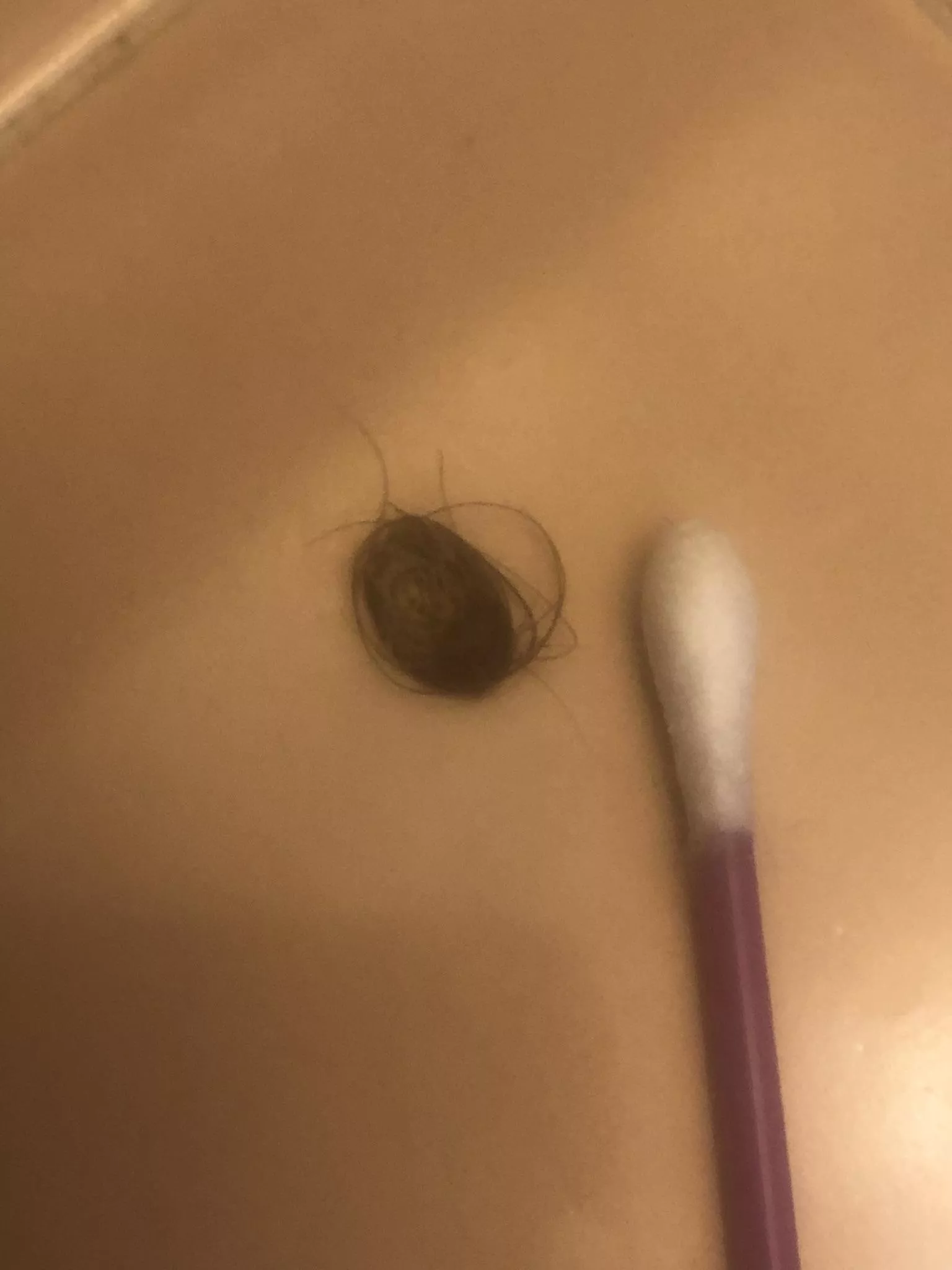 I've had an ingrown hair for years. Finally got it out. Q-Tip for scale. posted by iconoclast63