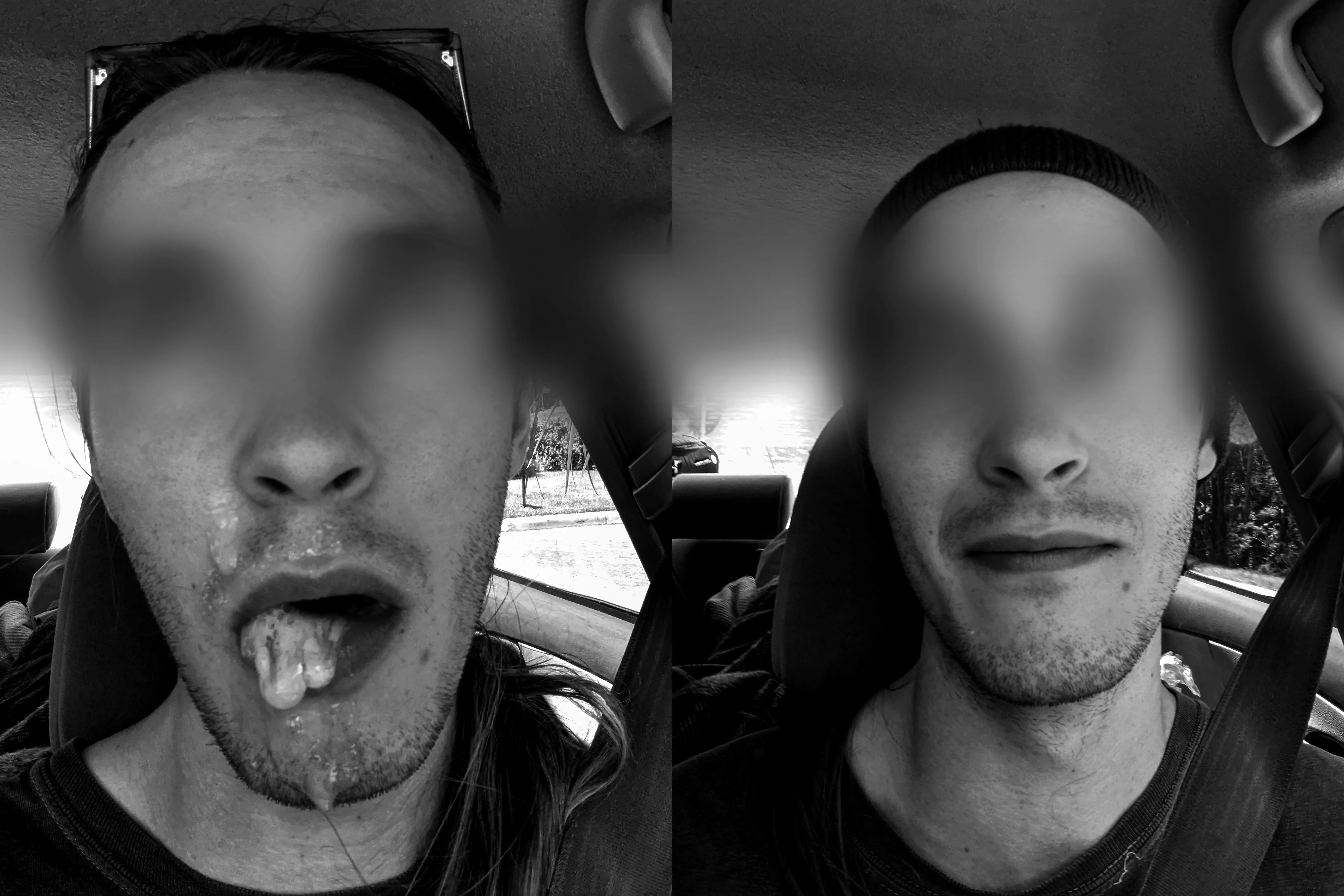 Before / After posted by throwaway_0824a