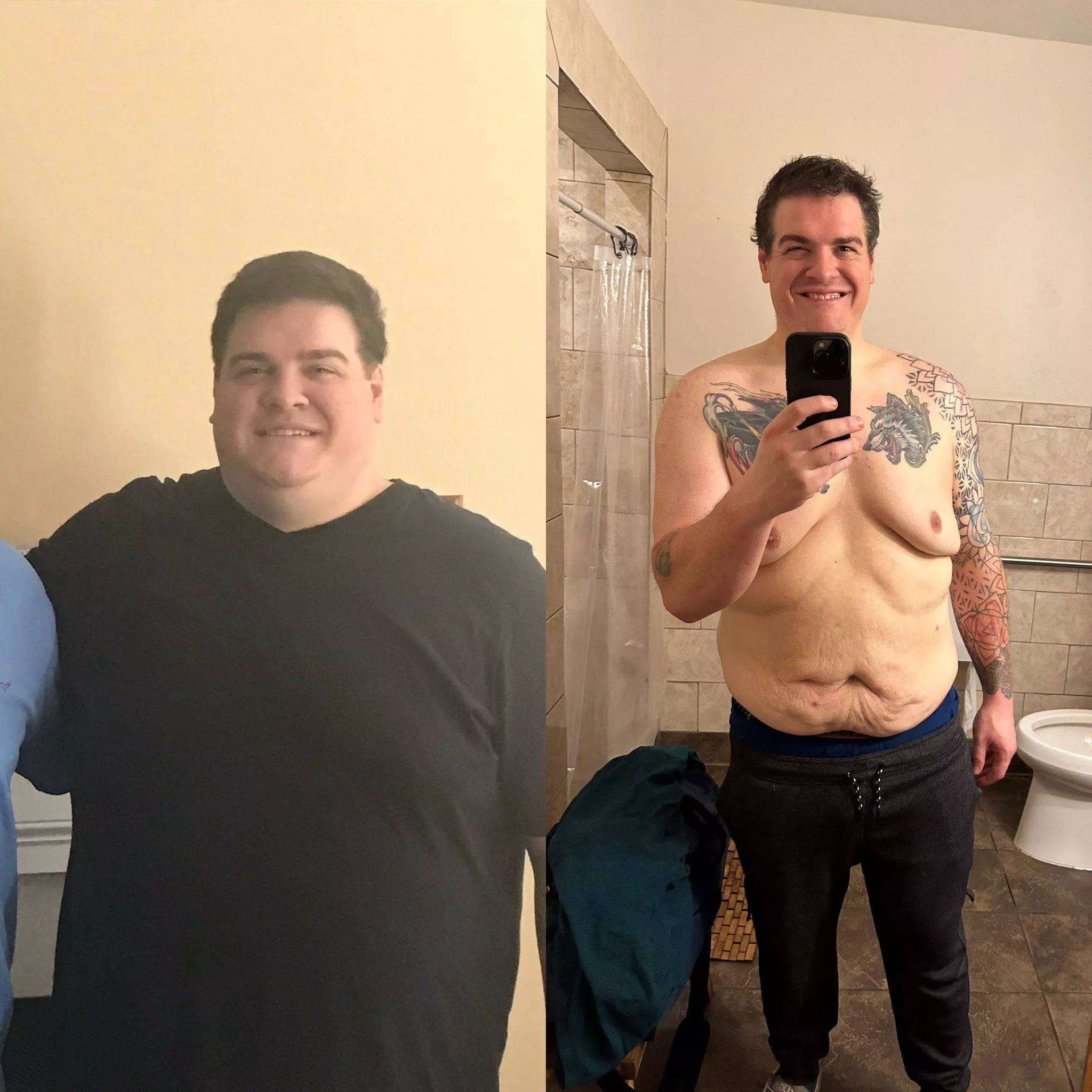 Finally crossed the 150lbs lost milestone and actually starting to have some body positive days posted by Sweetzombjesus