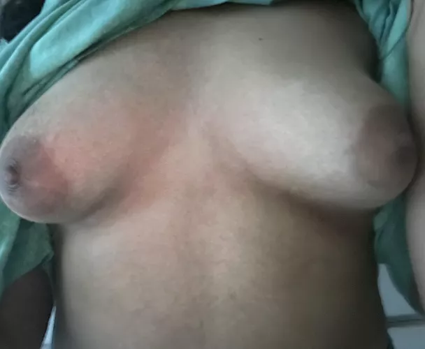 They’re weird when they’re hard. I lost weight and they’re ruined :( by eventuallythebest