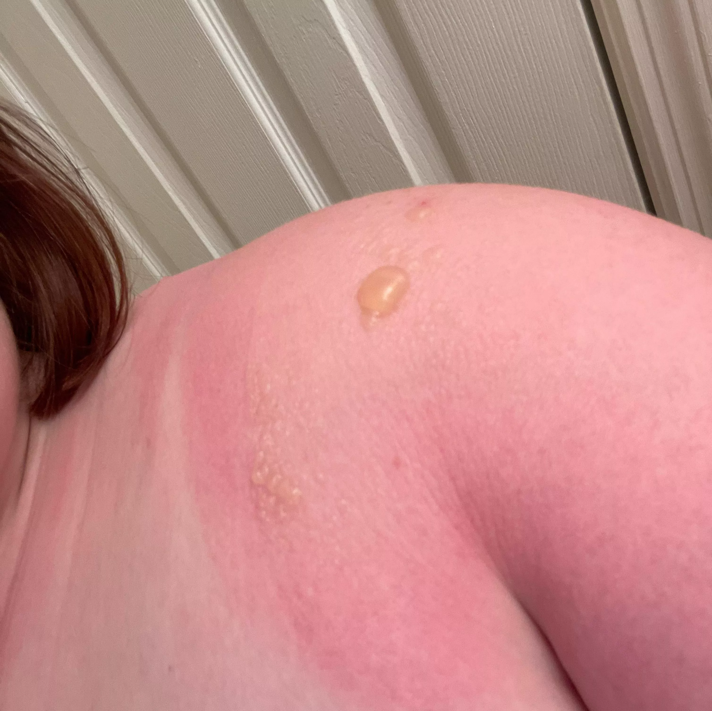 Forbidden shoulder pops (souvenirs from TWICE concert) posted by Cheap-Geologist-9231