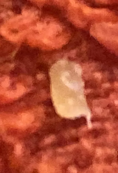 Just exhumed this piece of death from my chin by Sameon104