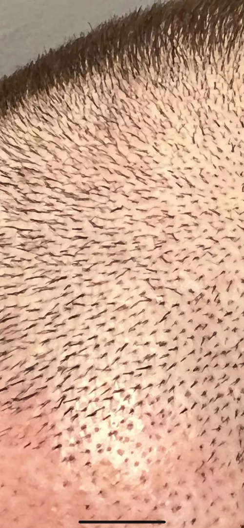 My hair is a subterranean briar patch. by Melodic-Award3991