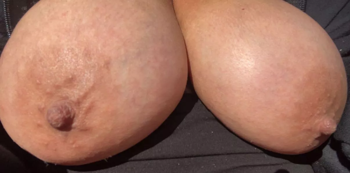 My saggy udder out in Sun - would you please Them? posted by cutiie01