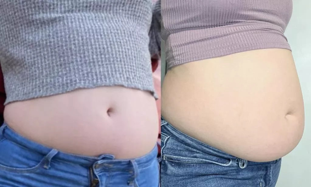 How my “skinny girl” crop tops used to fit vs. how they fit now 😜😅 posted by jordanjigglez