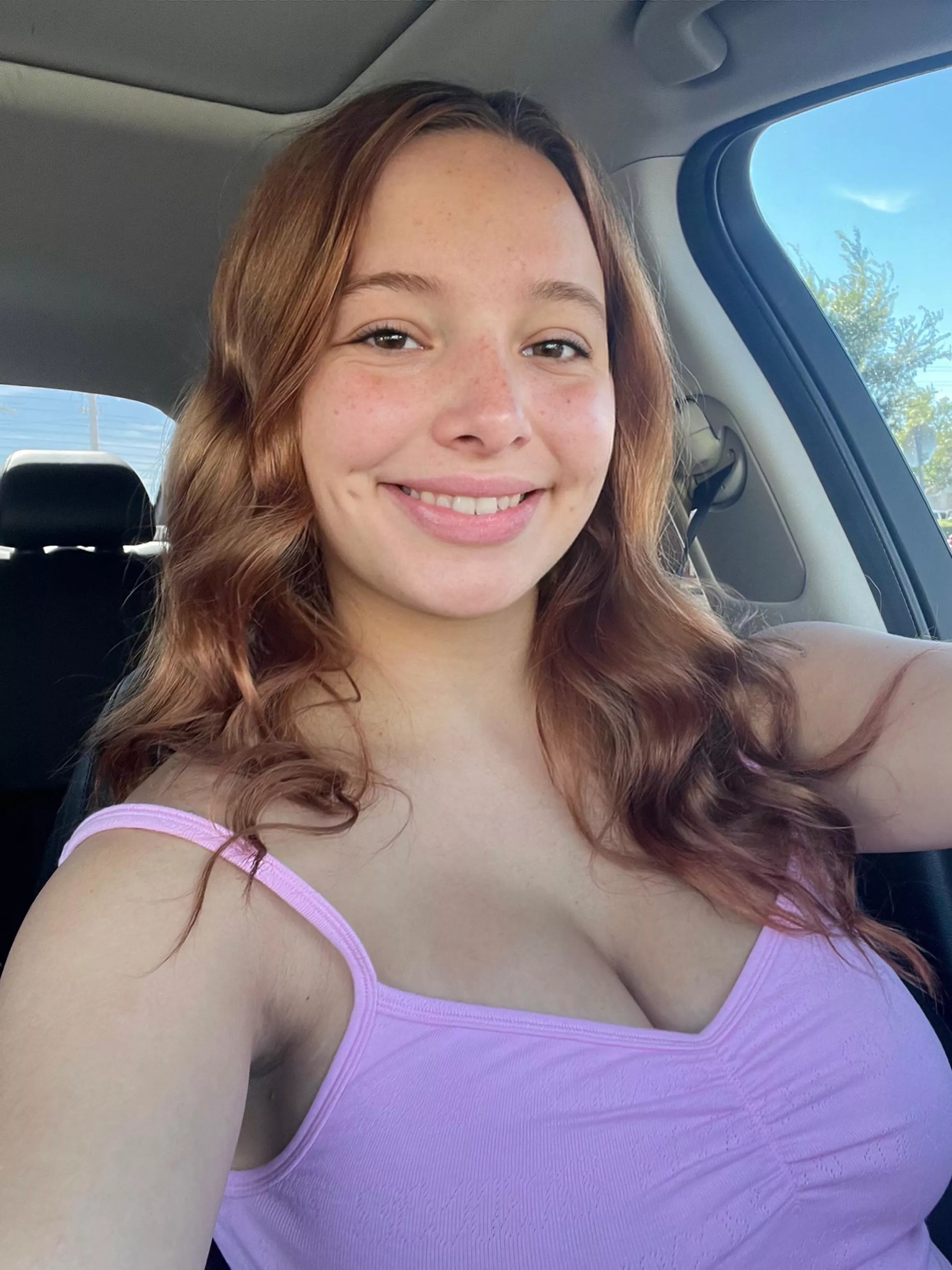 The sun has been making my freckles come out to play posted by kencake