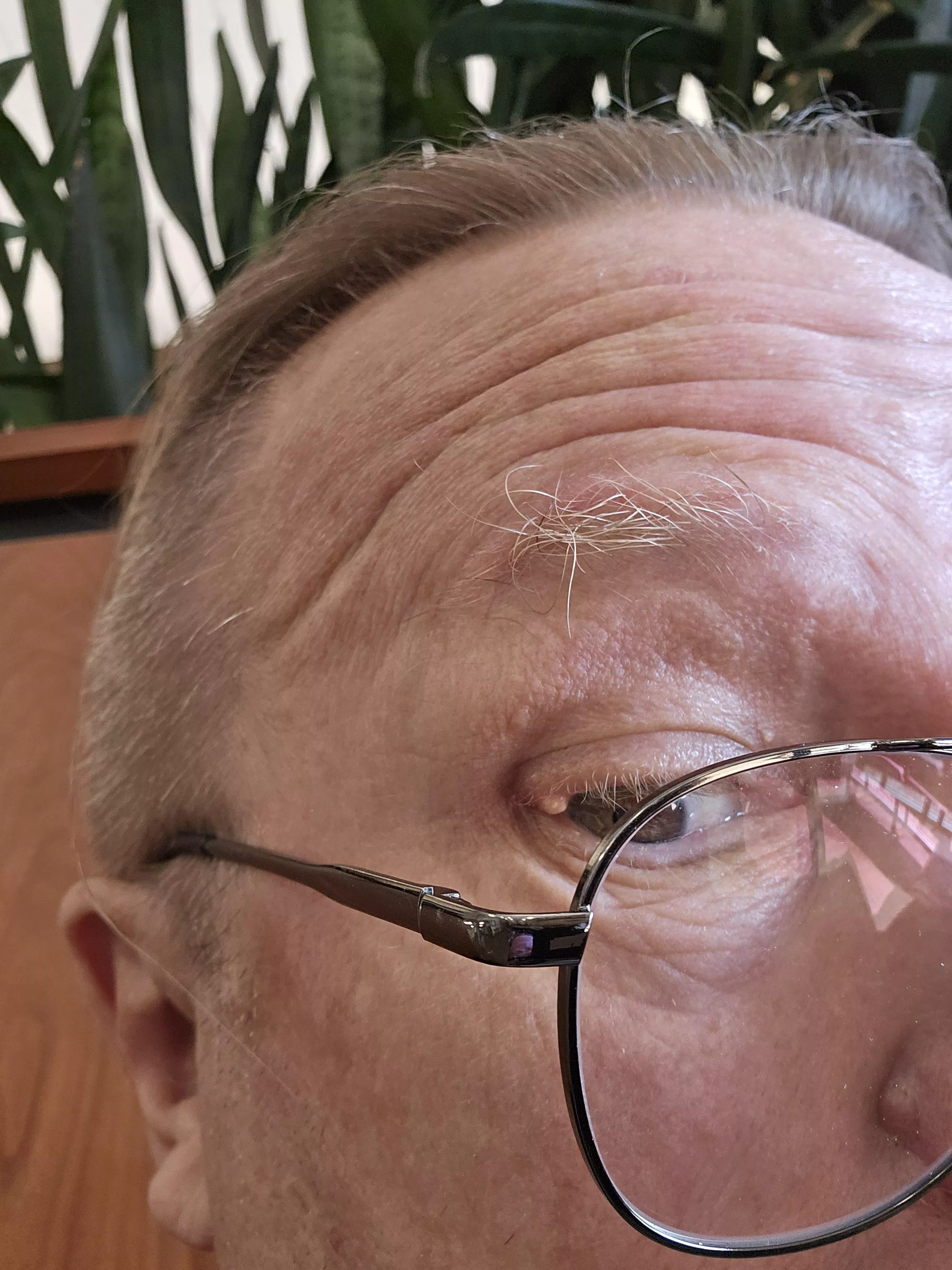 Stye Update, do sending me to specialist Monday. Plugged eyelash folicle. posted by Vault76exile