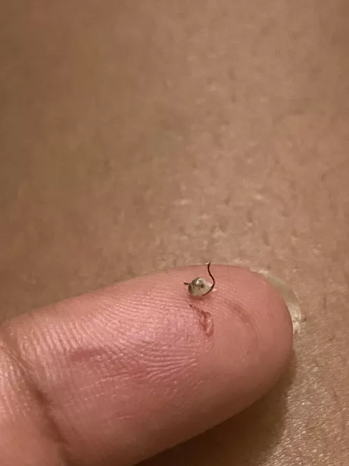 Unexpected pubic pop result by AnaphylacticTruth