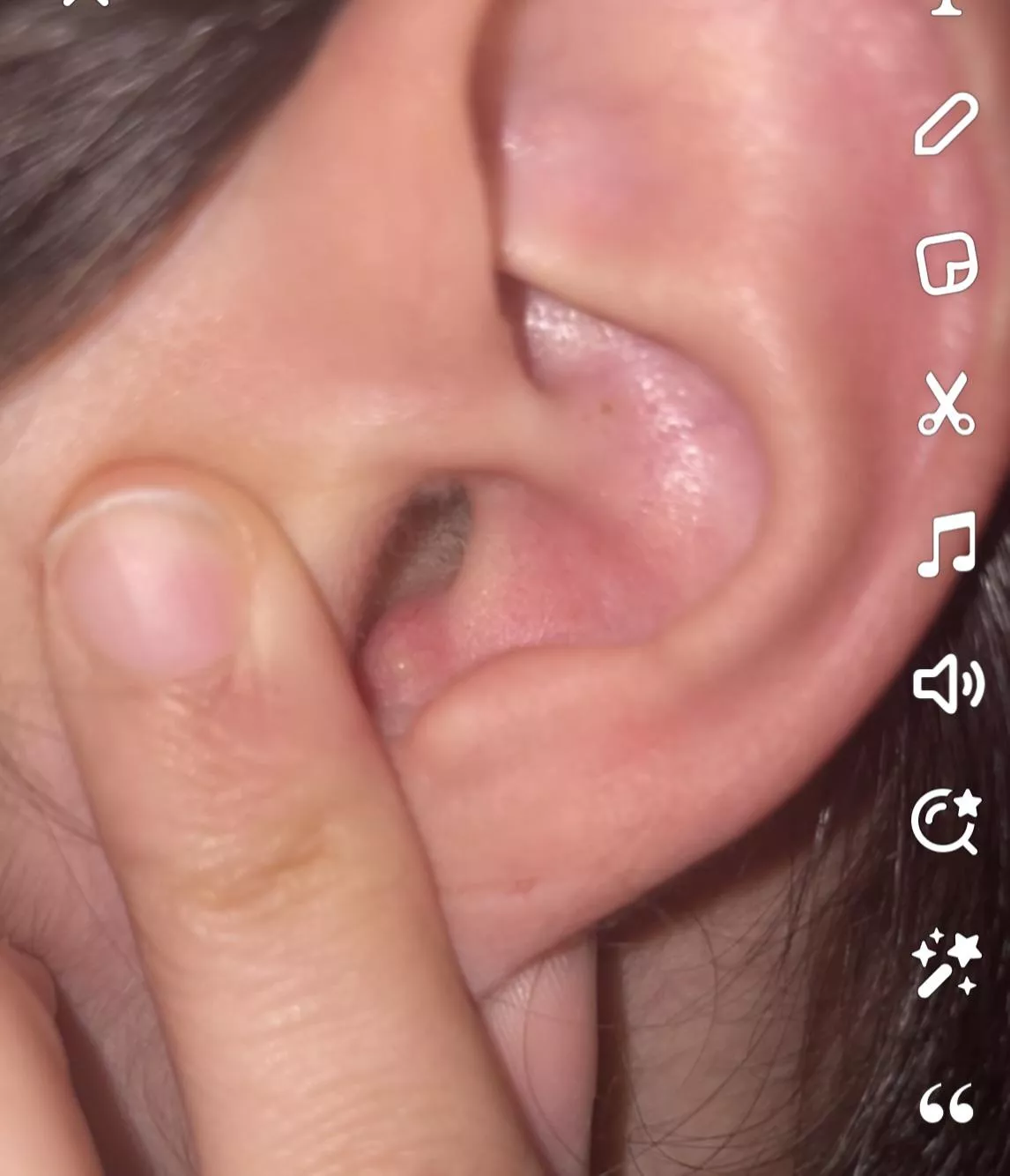 What is this In my ear? posted by lilly12334
