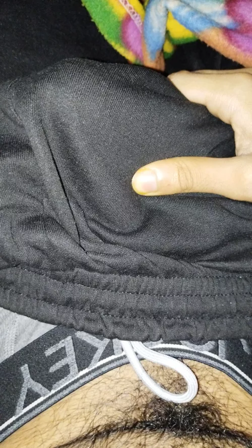 It's such a pain to try to hide it whenever it gets straight by Electrical-Fault-401