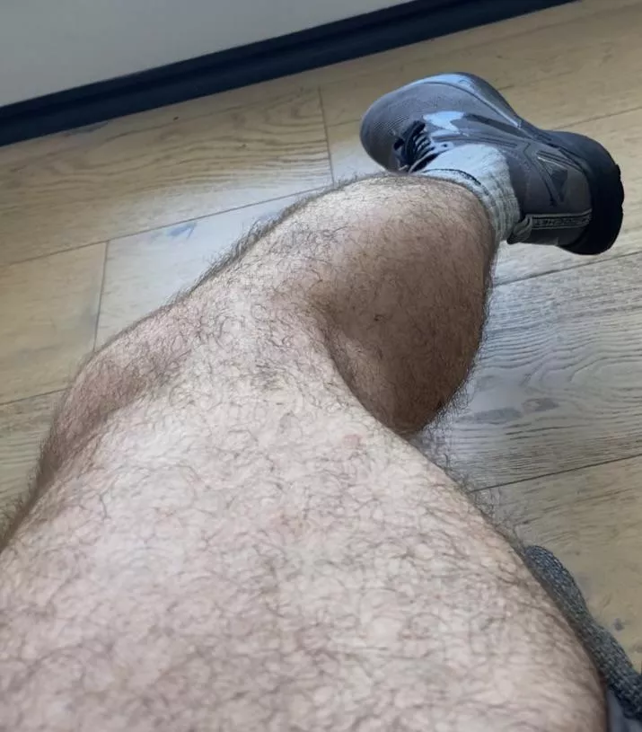 My leg was just hanging around so I took a pic of it. posted by WhatsInTheBox926