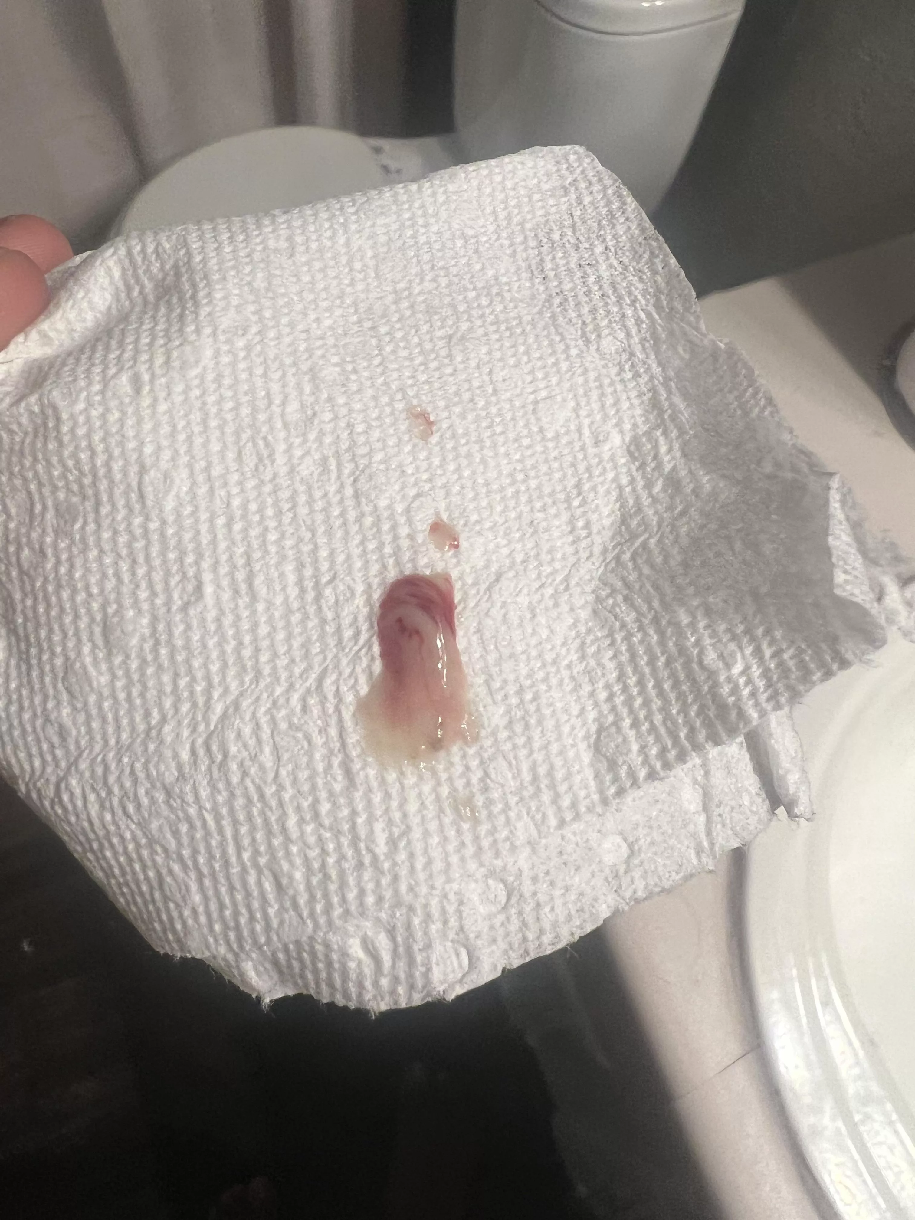 Pop from boyfriends thigh posted by MediumSuspicious8336