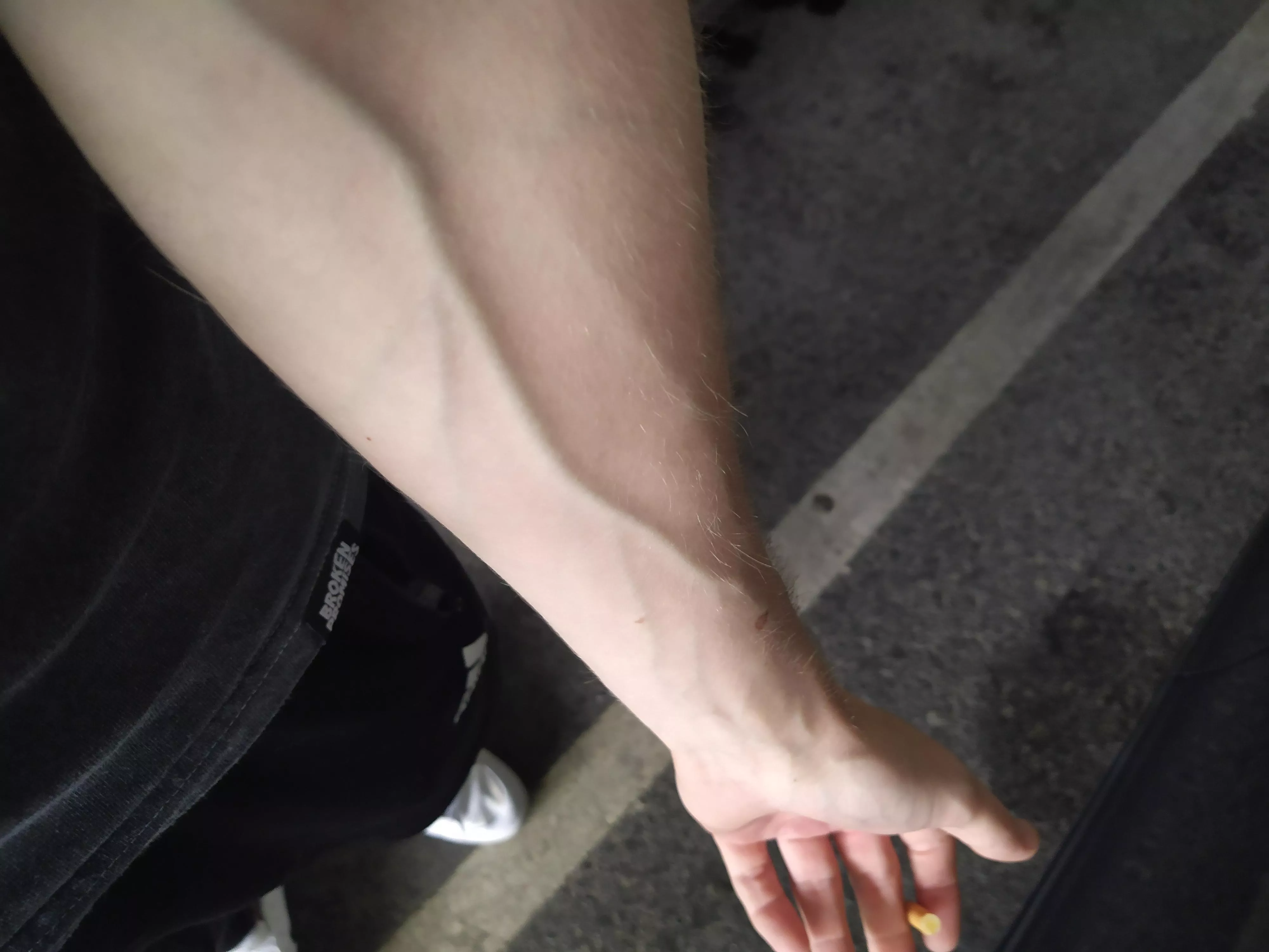 Long ways to go posted by Fckenstein