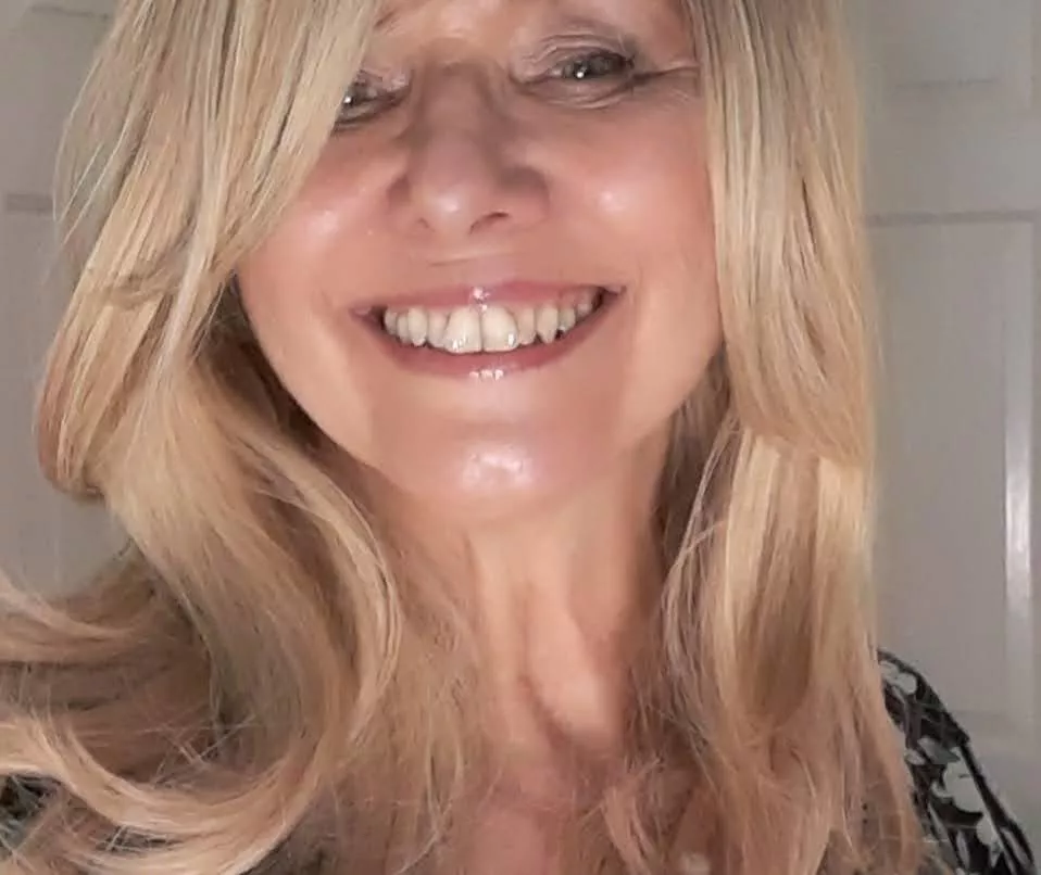 66 and still got all my own teeth. posted by Emily_english57