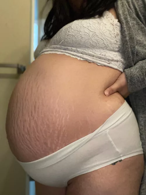 20 weeks of growing 🤰🏻💕 by Milkymooon66