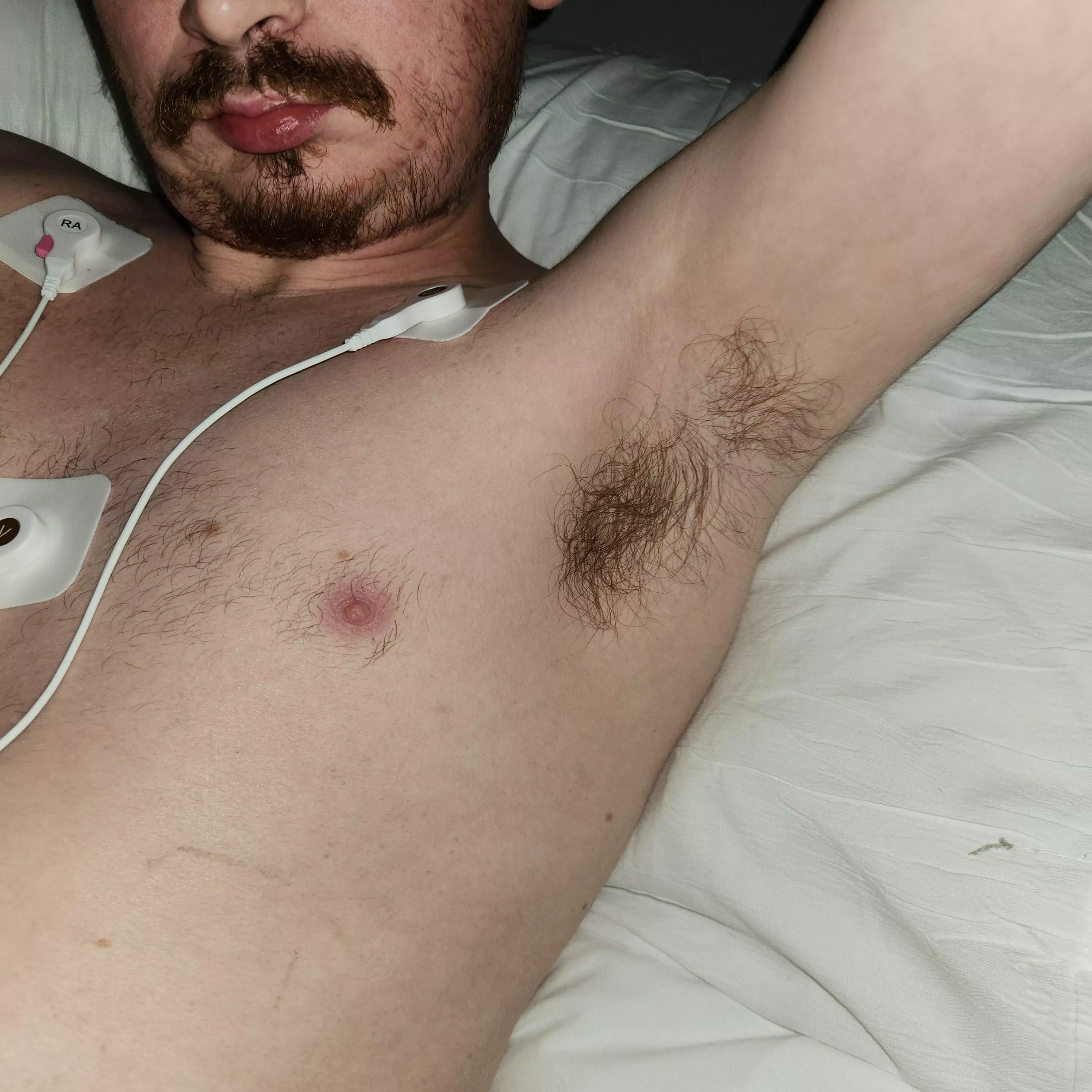 Bored in the hospital. Hmu posted by PitifulBlackberry735