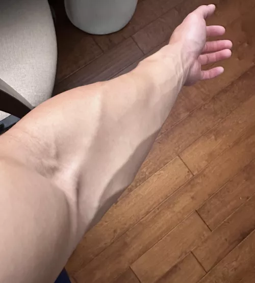 Mass and veins by Tree_forearms