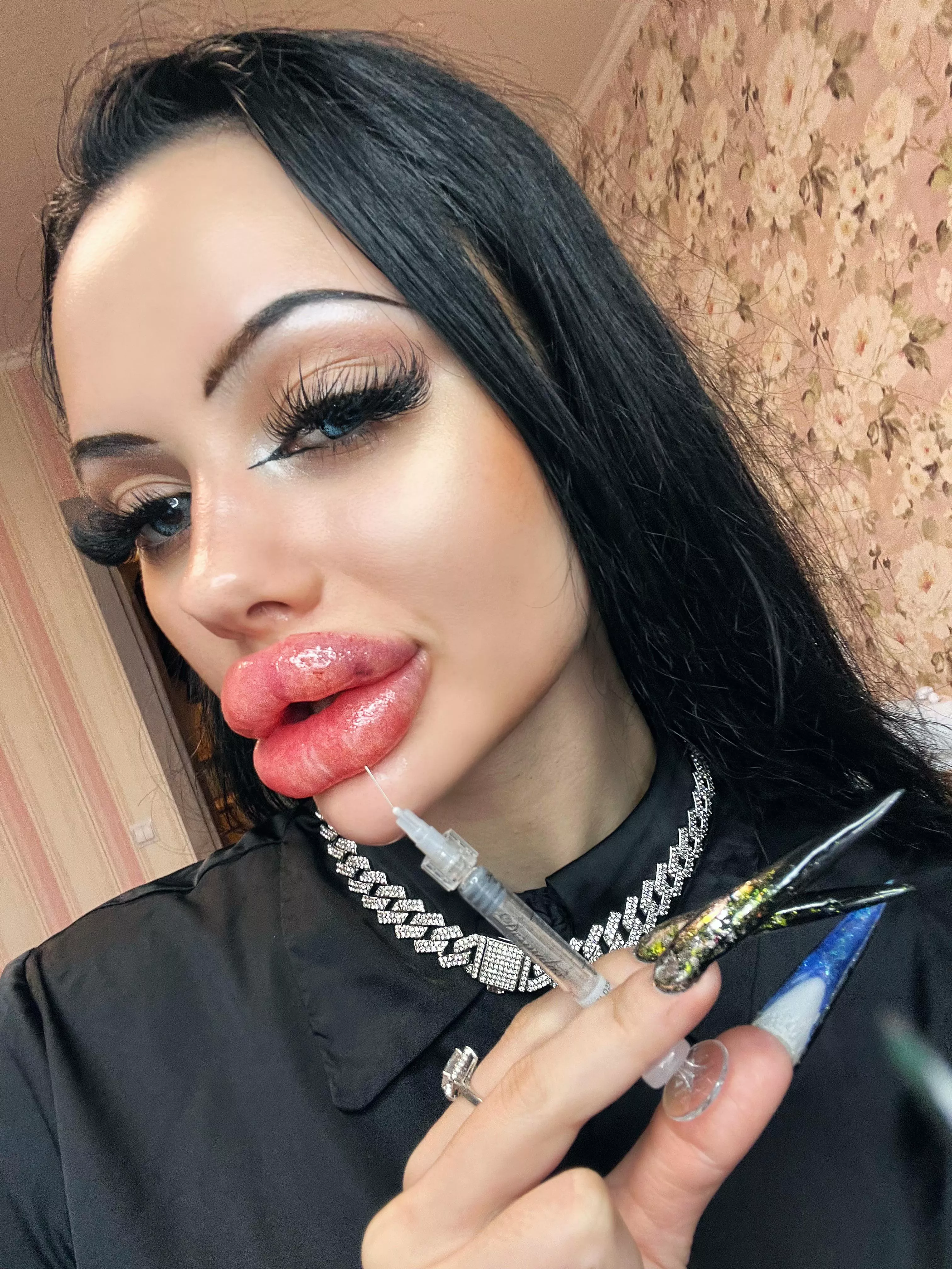 Again and again, can’t stop injecting posted by Fine-Ad2329