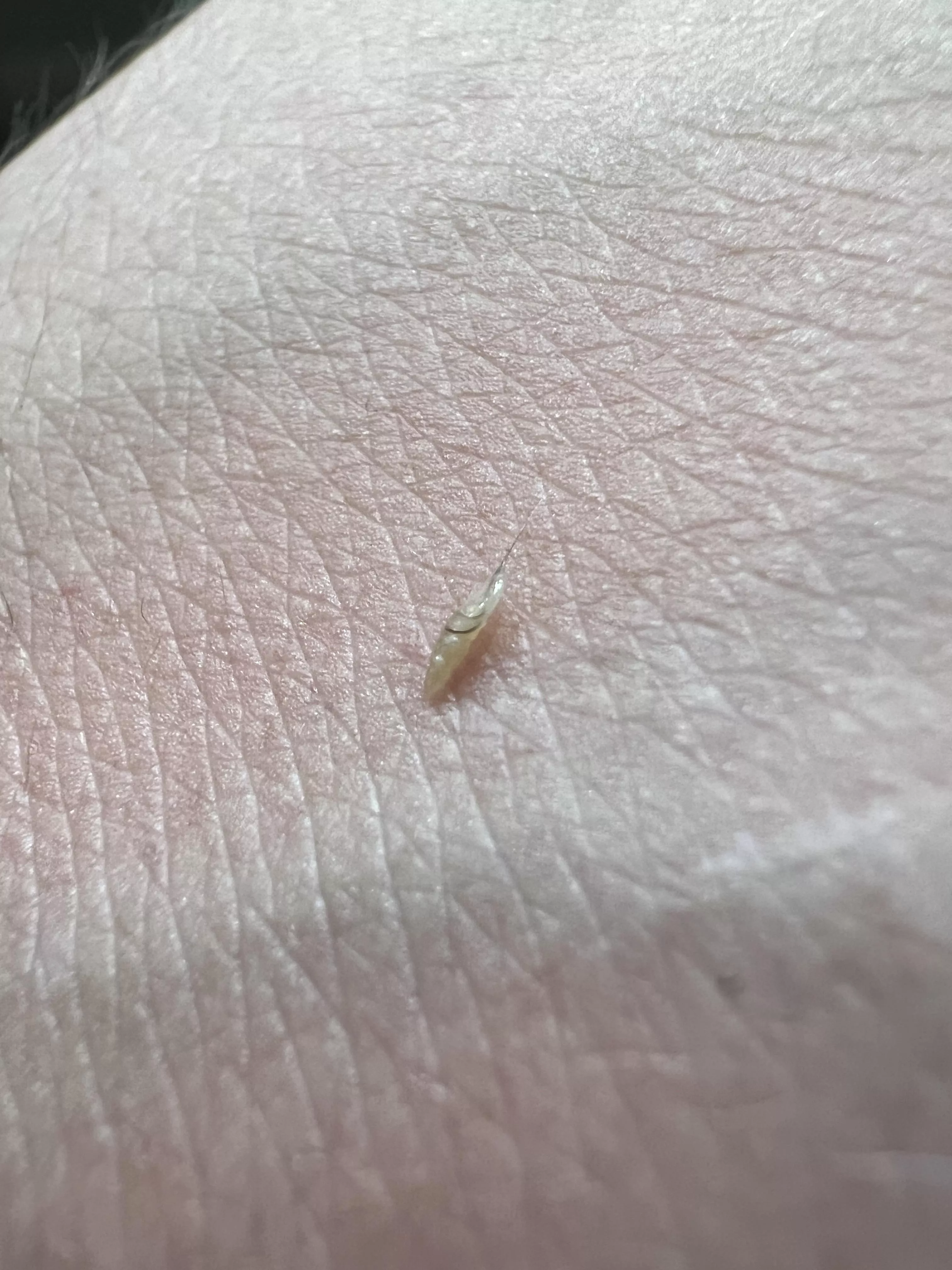 Sorry no video, but this fella was buried on my stomach posted by PickleTickIer