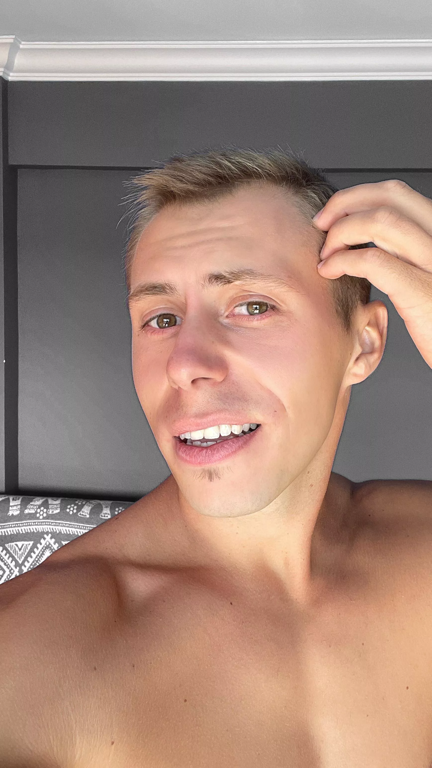 Who is also unlucky with the hairline ? posted by carry_fit_free