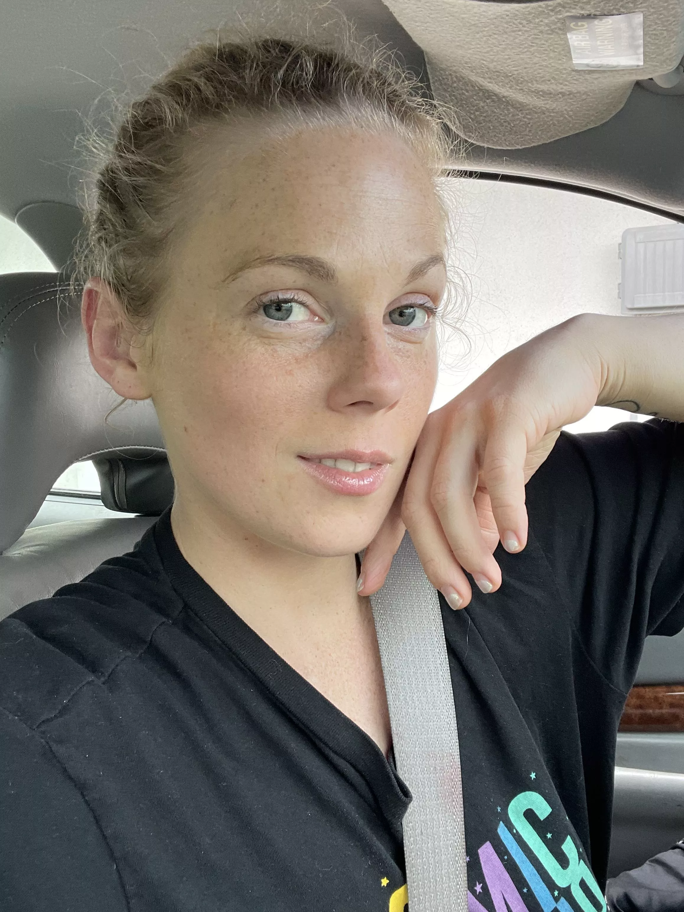 Freckles to brighten your day posted by Amputeelove