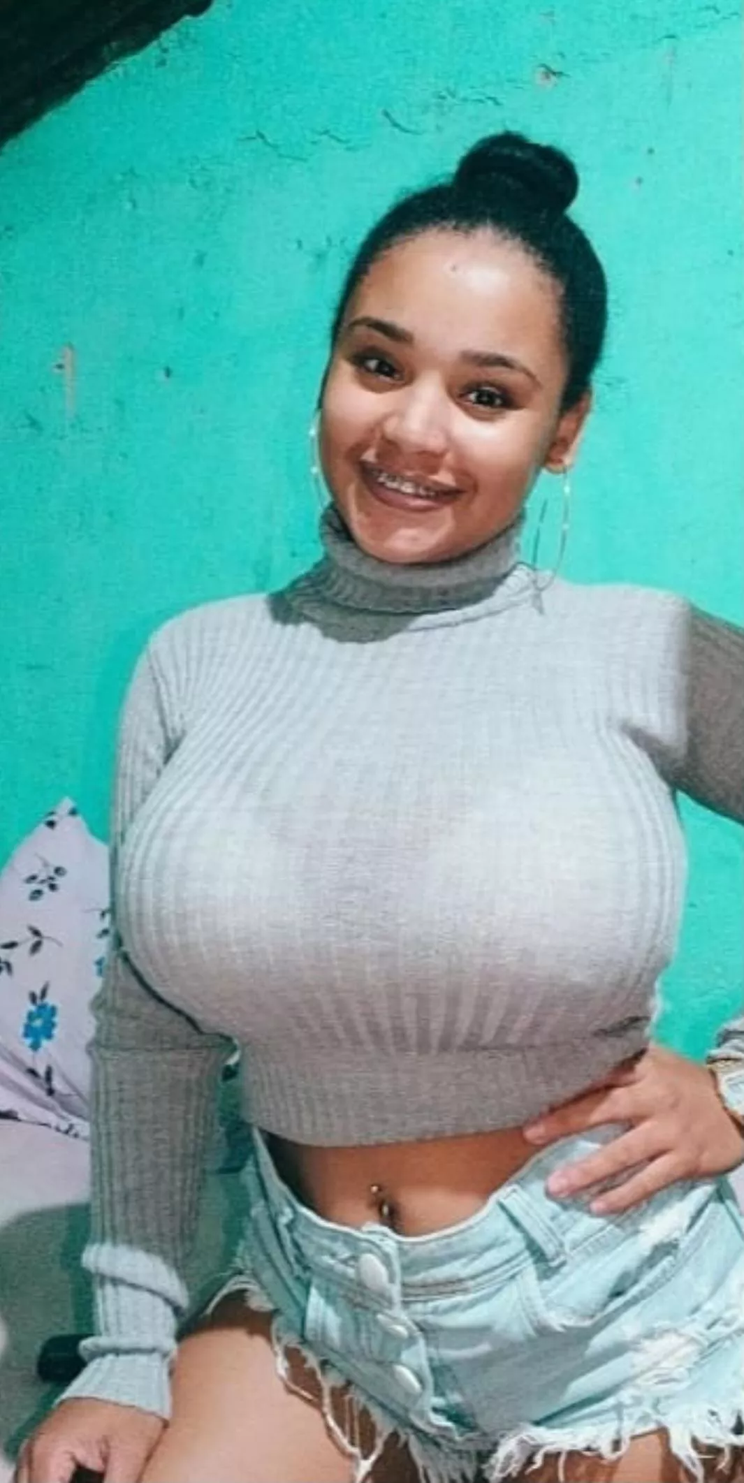 Tortleneck will hide them of course posted by Important-Site-9350