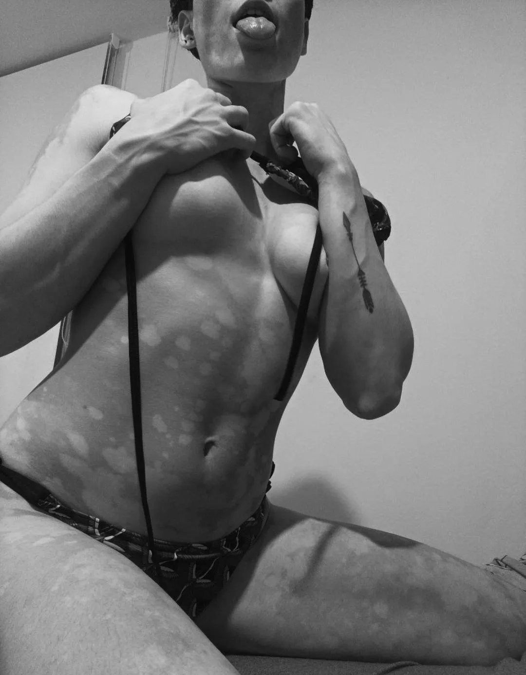 Do you want a lick? posted by yourvitiligogirl