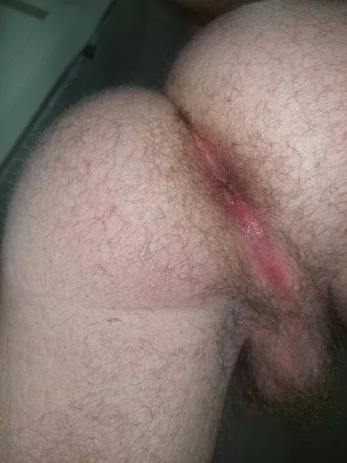 Do you like furry man asses? by straight_gayymer