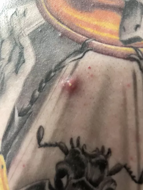 His back, before the pop by nayaya