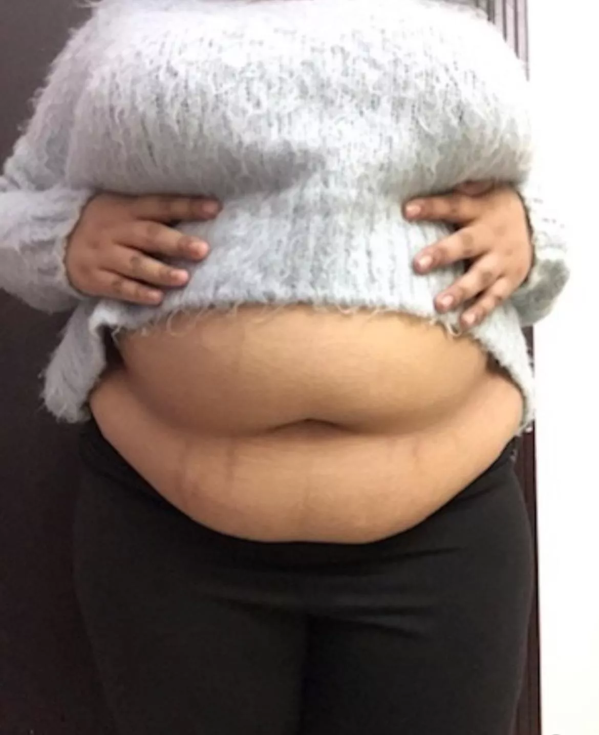 I get wet from being teased and praised about my belly 🙈 posted by Known-Significance26