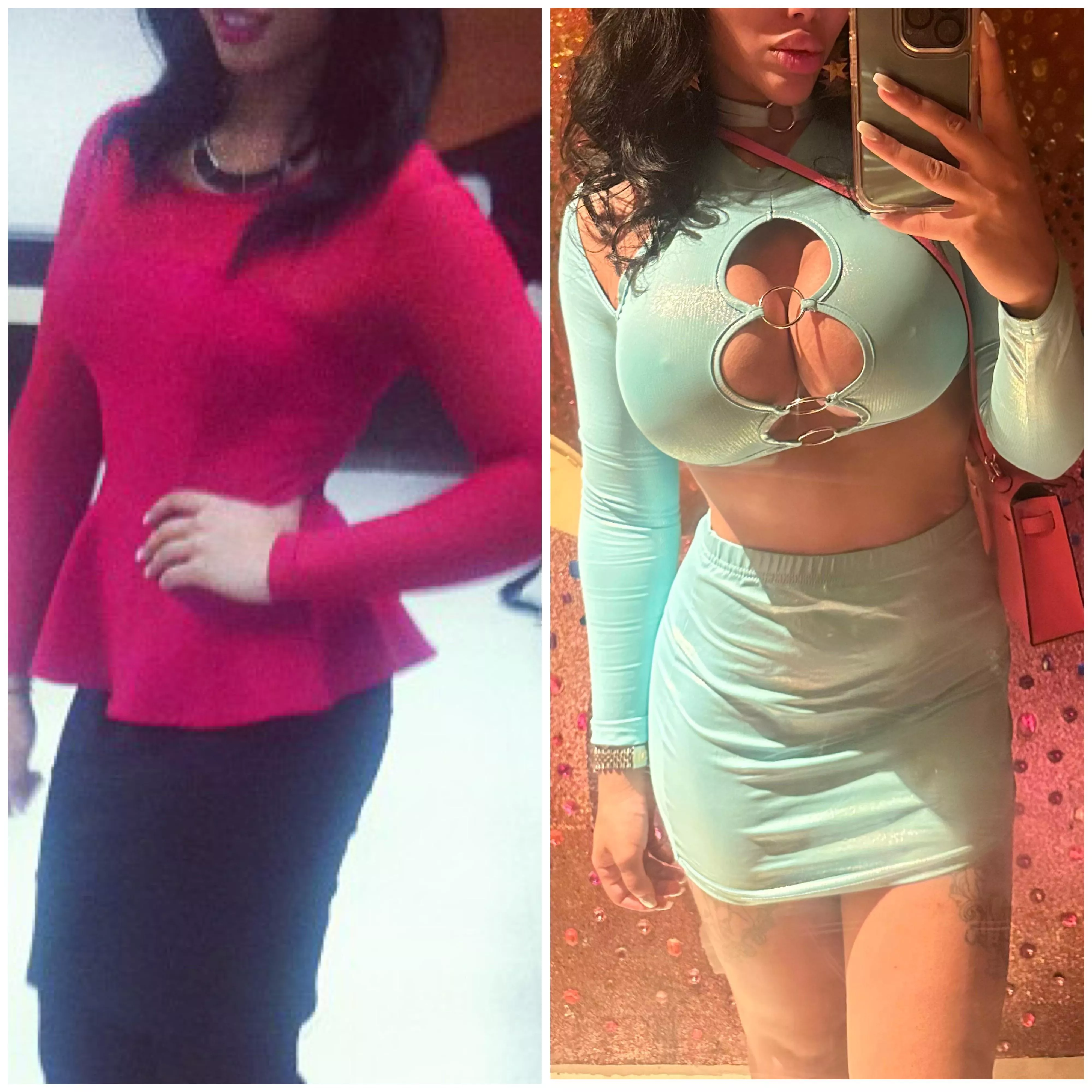 (OC) 10 year difference and 5 hours before flipping over my left implant 😭😭 posted by femmeparallel