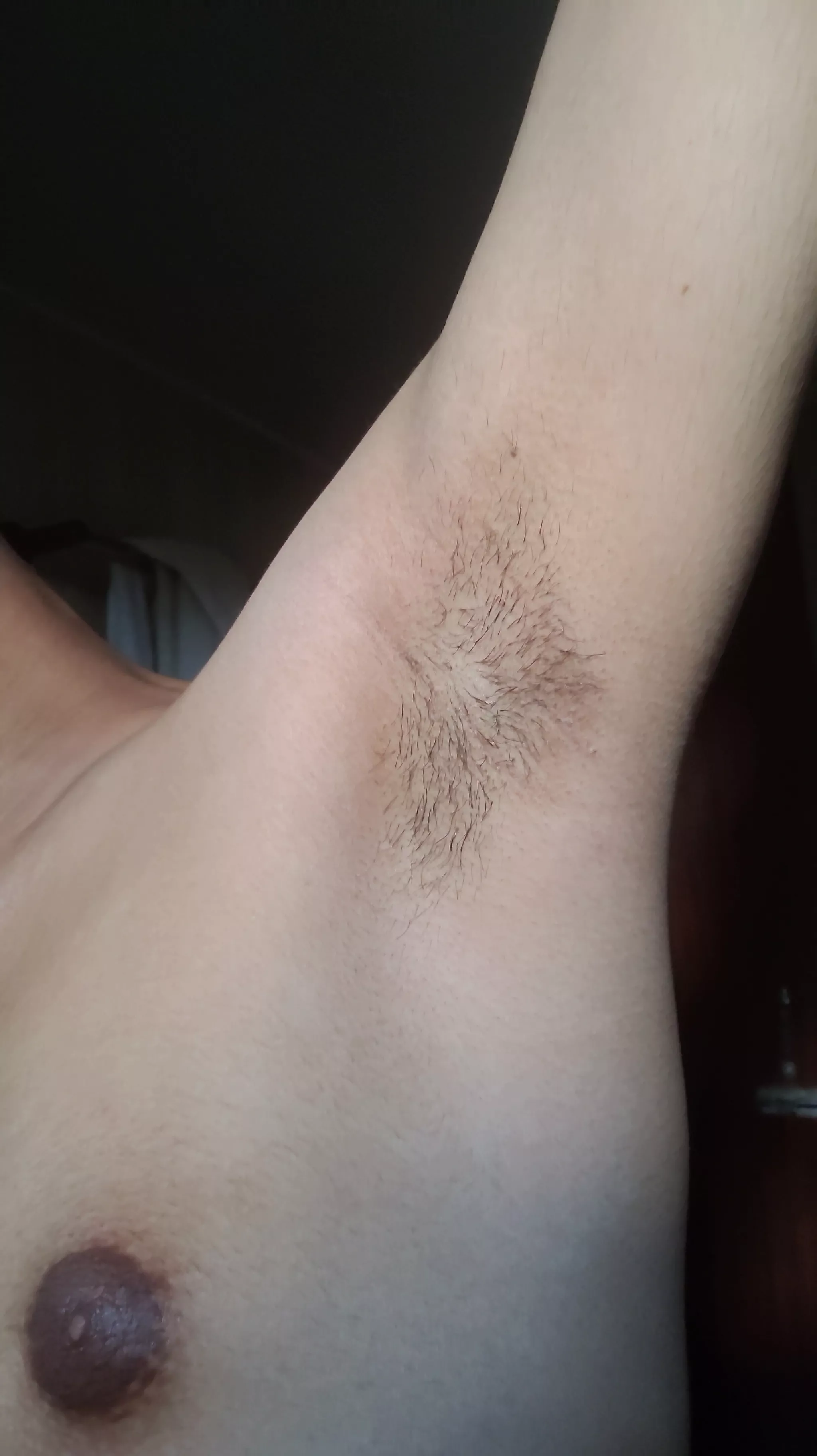 Before shower posted by Sharp_Dog_7575