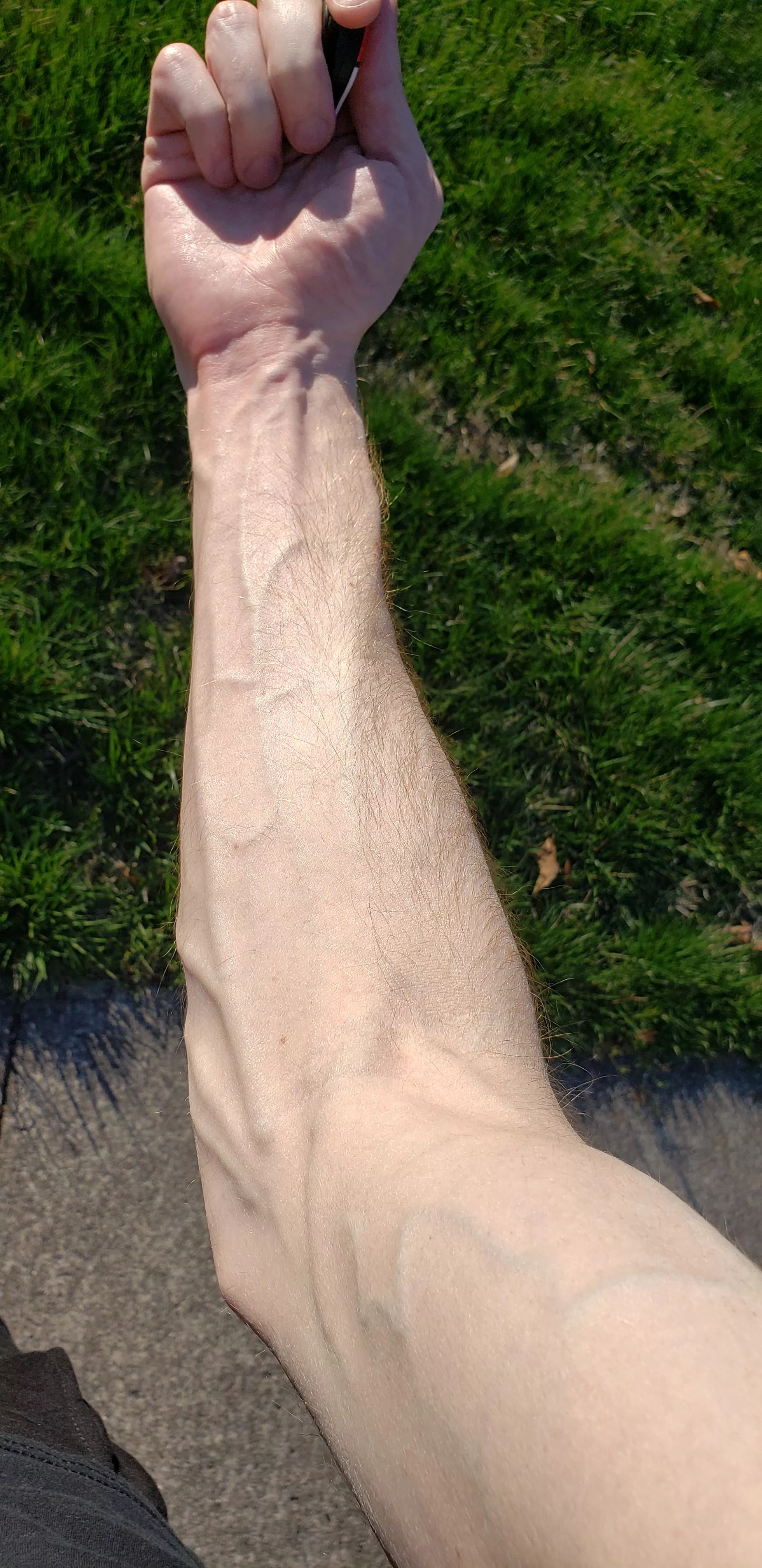 Got blood drawn today and the nurse said it was the easiest draw they'd ever done posted by ClearandSweet