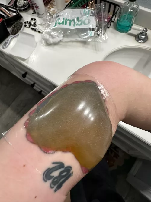 Saw this in the tattoo removal subreddit 😳 by shroomsaregoooood
