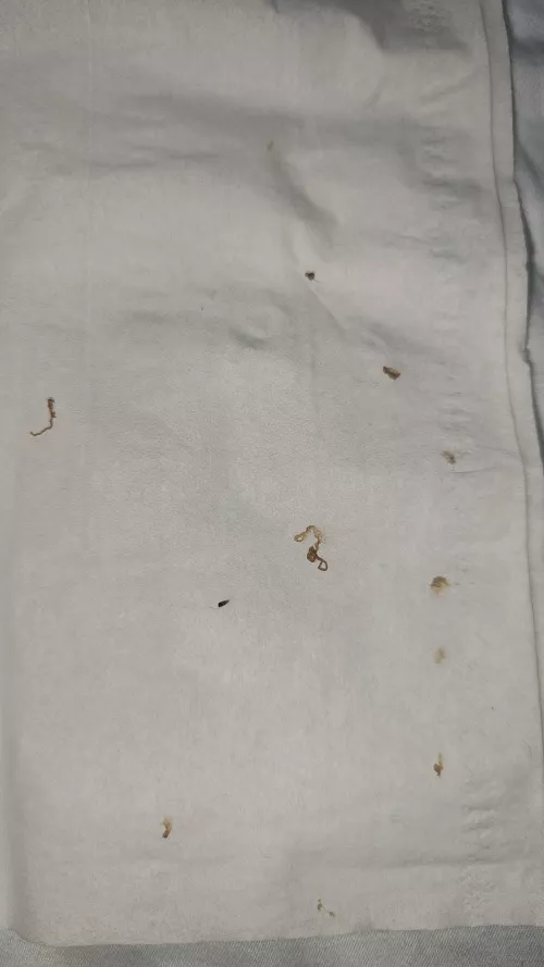 Wife attacked my back tonight. Blackhead/Cyst by The4aK3AzN