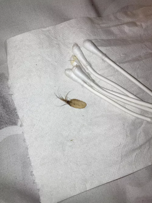 Yanked this from my belly button by Ghaidheal