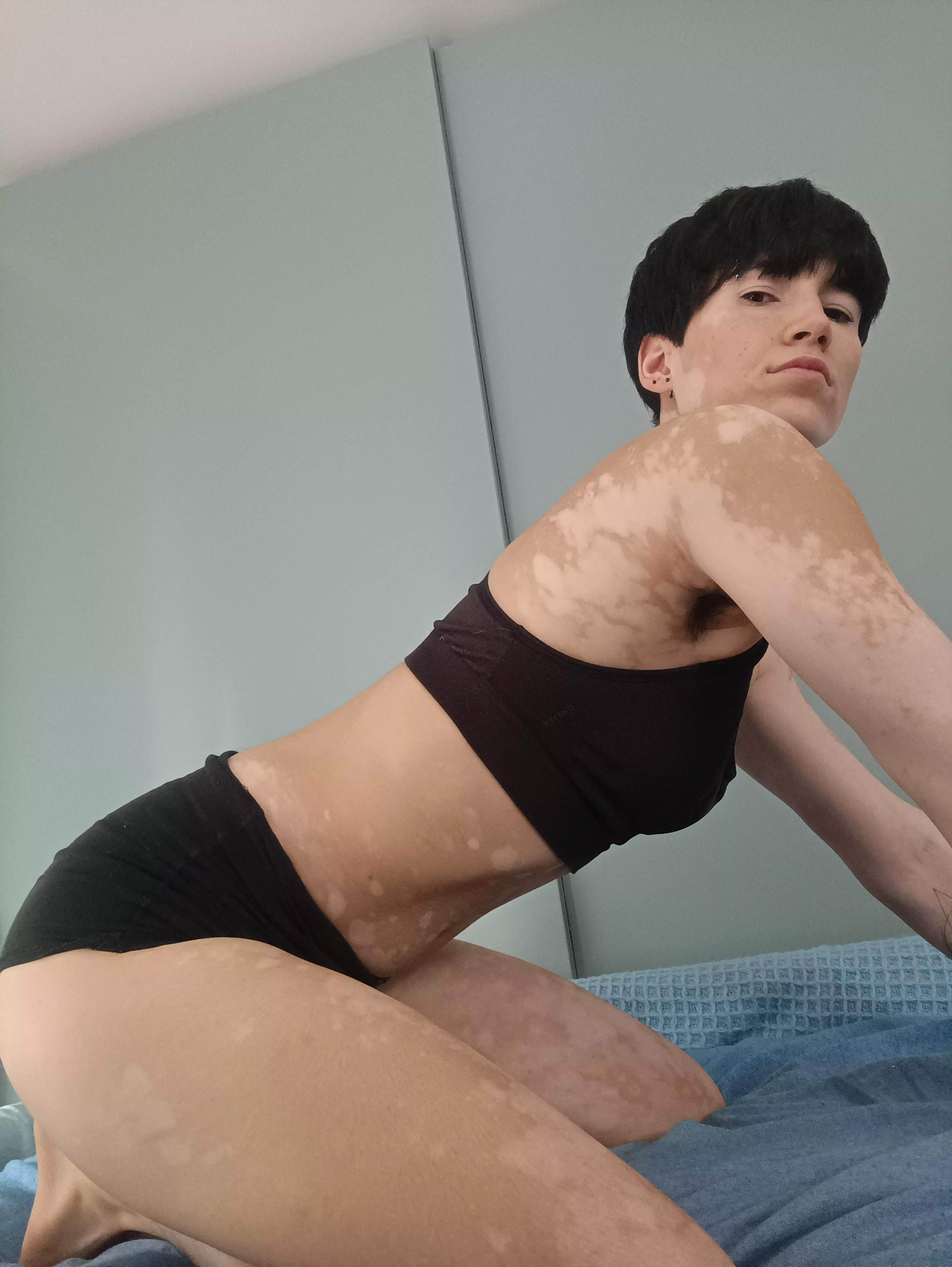 Do you like what you see? posted by yourvitiligogirl